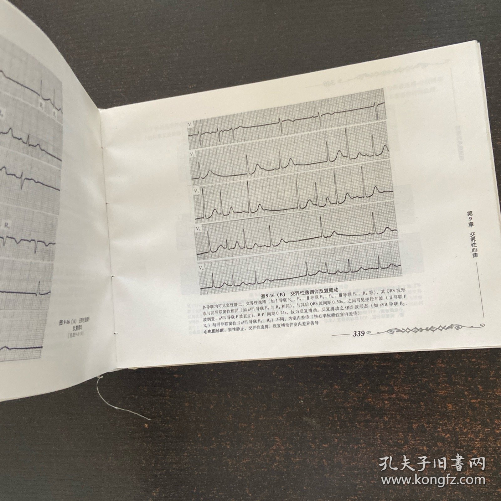 异常心电图图谱