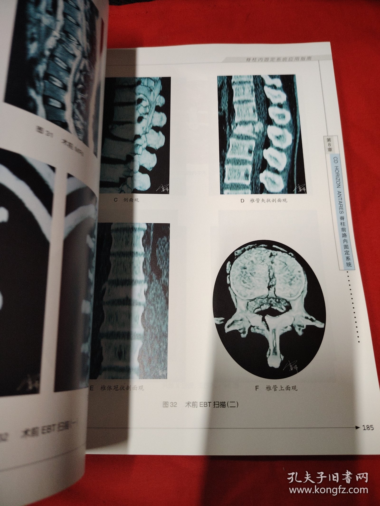脊柱内固定系统应用指南
