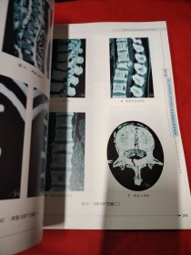脊柱内固定系统应用指南