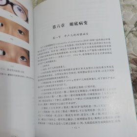 儿童常见眼病诊断图谱