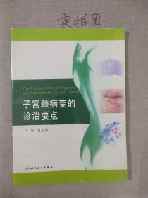 子宫颈病变的诊治要点