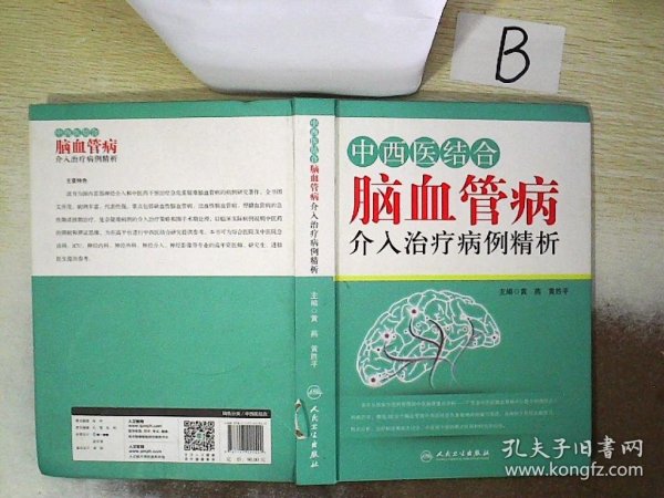 中西医结合脑血管病介入治疗病例精析