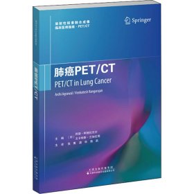 肺癌PET/CT