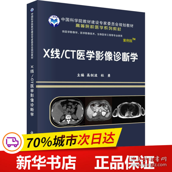 X线/CT医学影像诊断学