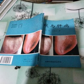 舌纹与肝病