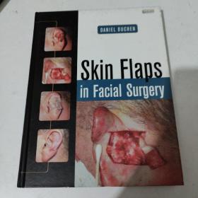 Skin Flaps in Facial Surgery 面部手术中的皮肤