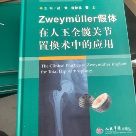 Zweymǘller假体在人工全髋关节置换术中的应用