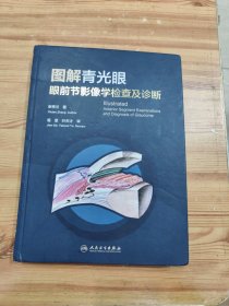 图解青光眼 眼前节影像学检查及诊断 (签赠本)