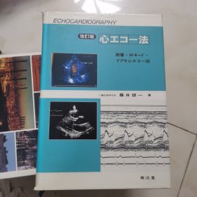 心工コー法 一 超音波心断层図とMモード心工コー図