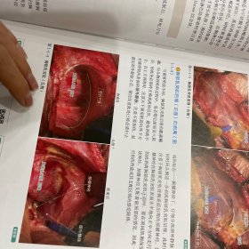 腹腔镜外科局部解剖图谱解剖路径与手术操作。