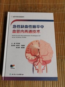 急性缺血性脑卒中血管内再通技术