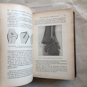 PRECIS CLINIQUE ET OPERATOIRE DE CHIRURGIE INFANTILE 儿童外科的临床和手术 外文古旧书 民国老外文书 精装 1925