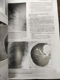 影像诊断学基础教程（第3版）（影印）