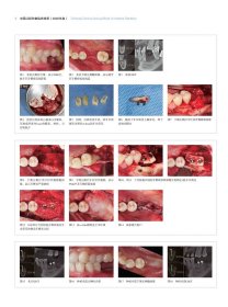 正版书中国口腔种植临床精萃2020年卷