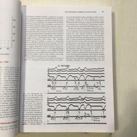 临床诊断 Clinical cardiac elrctrohysiology techniqurs and intetptetations