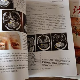 脑血管病诊断与鉴别诊断：临床实例图示