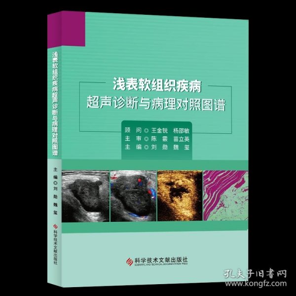 浅表软组织疾病超声诊断与病理对照图谱