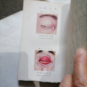 《外眼病图谱》民国日文版一册～包邮
