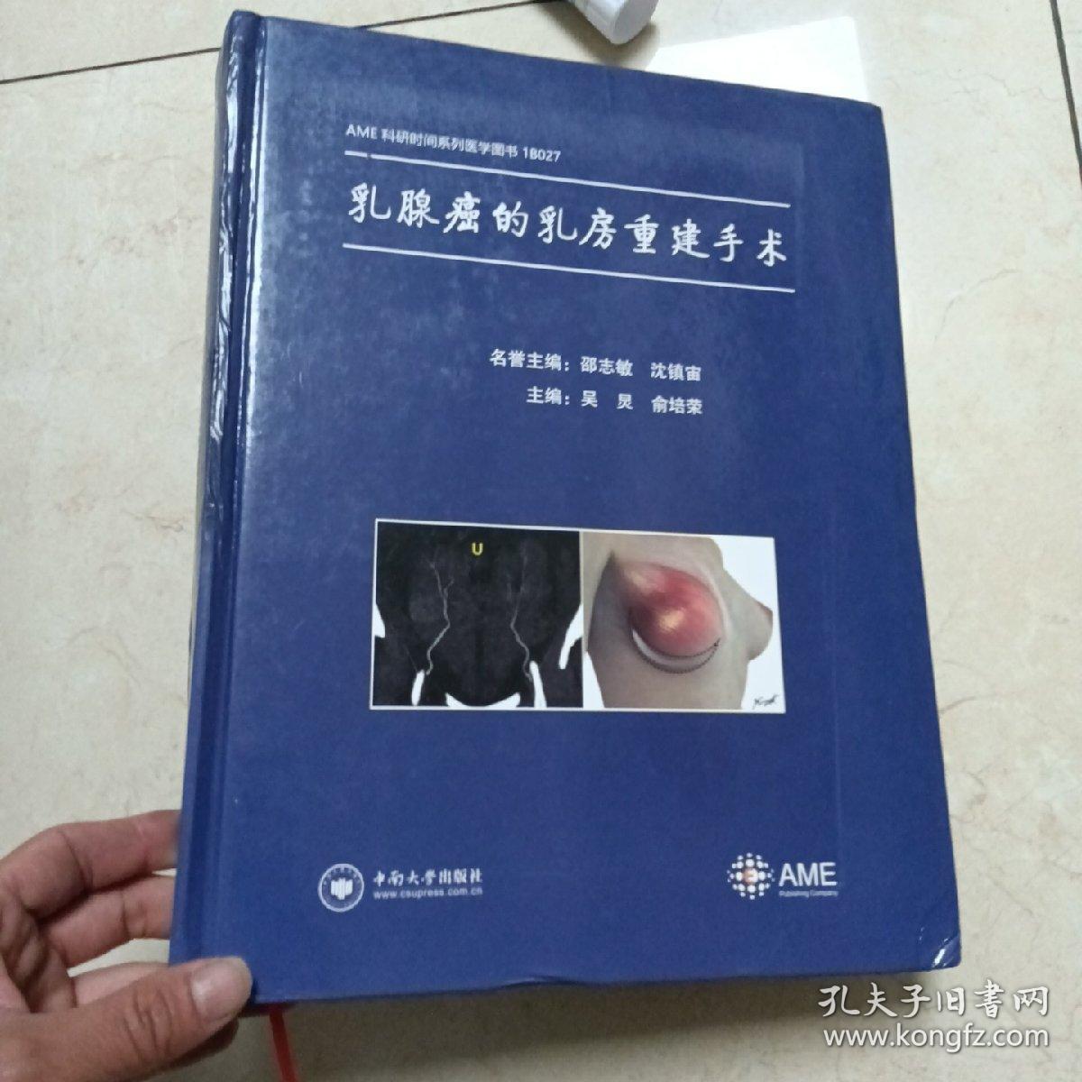 乳腺癌的乳房重建手术