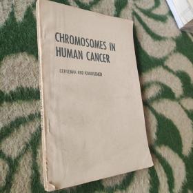 CHROMOSOMES IN HUMAN CANCER(人癌瘤中的染色体)