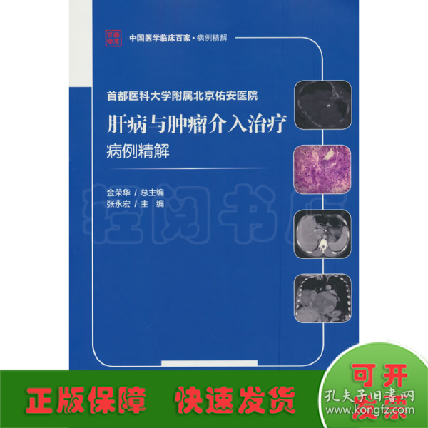 首都医科大学附属北京佑安医院肝病与肿瘤介入治疗病例精解