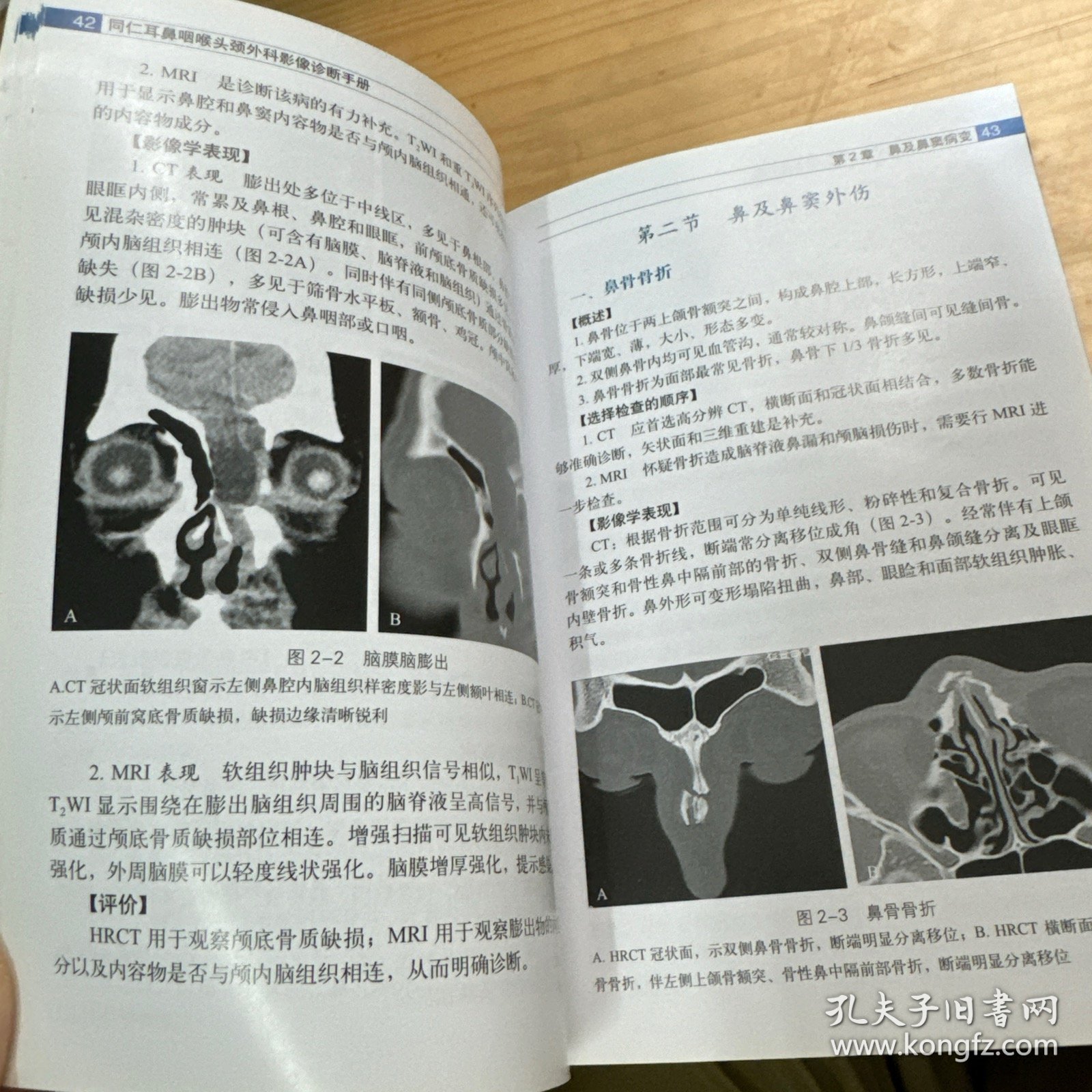 同仁耳鼻咽喉头颈外科影像诊断手册 几乎全新