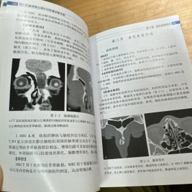 同仁耳鼻咽喉头颈外科影像诊断手册 几乎全新