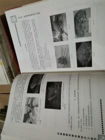 肝胆胰脾疾病的微创介入治疗