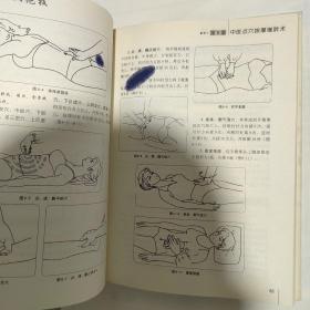 中医点穴按摩八大绝技全图解