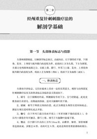 经颅重复针刺刺激疗法
