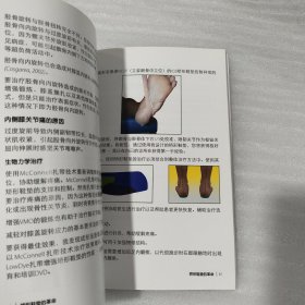 矫形鞋垫的革命