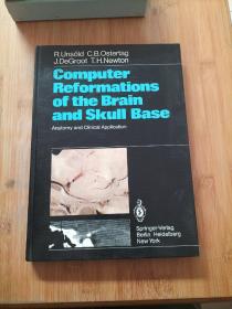 Computer Reformations of the Brain and Skull Base: Anatomy and Clinical Application