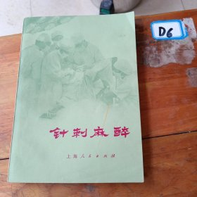 针刺麻醉