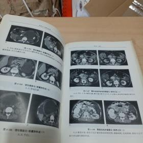 临床CT诊断学图谱