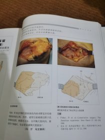 乳腺外科要点与盲点：乳腺外科要点与肓点