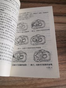 推拿治疗学