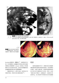 胃与肠：希望大家了解的十二指肠病变