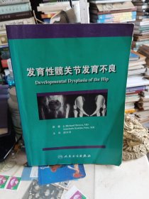 发育性髋关节发育不良