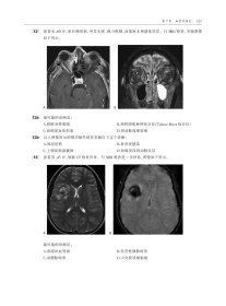 神经影像学：核心复习