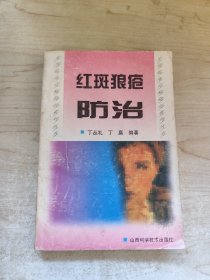 红斑狼疮防治