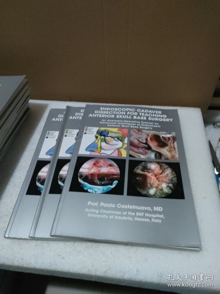 ENDOSCOPIC CADAVER DISSECTION FOR TEACHING ANTERIOR SKULL BASE SURGERY 内窥镜尸体解剖在前颅底外科教学中的应用【品如图】