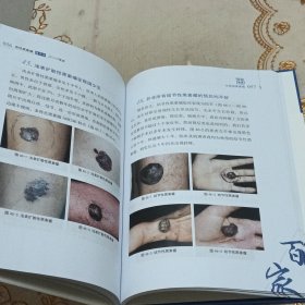 恶性黑素瘤高天文2019观点/中国医学临床百家