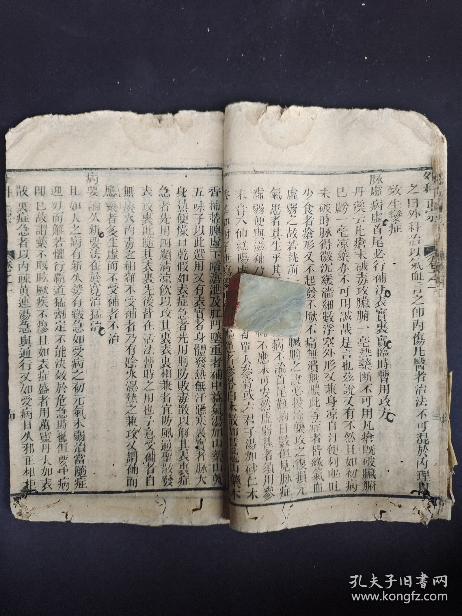 《外科正宗》卷一，清代木刻本。