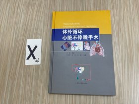 體外循環(huán)心臟不停跳手術(shù)