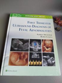 First Trimester Ultrasound Diagnosis of Fetal Ab