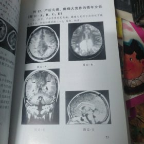 神经科疑难病例影像诊断分析  第一册