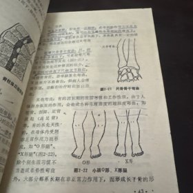 按摩正骨疗法
