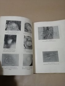 皮肤真菌病图谱