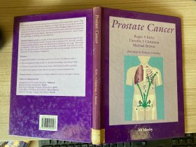 【英文原版】Prostate Cancer 前列腺癌