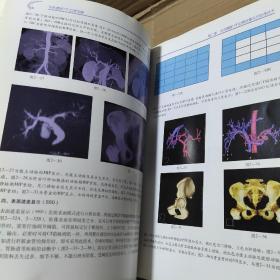 多层螺旋CT血管成像